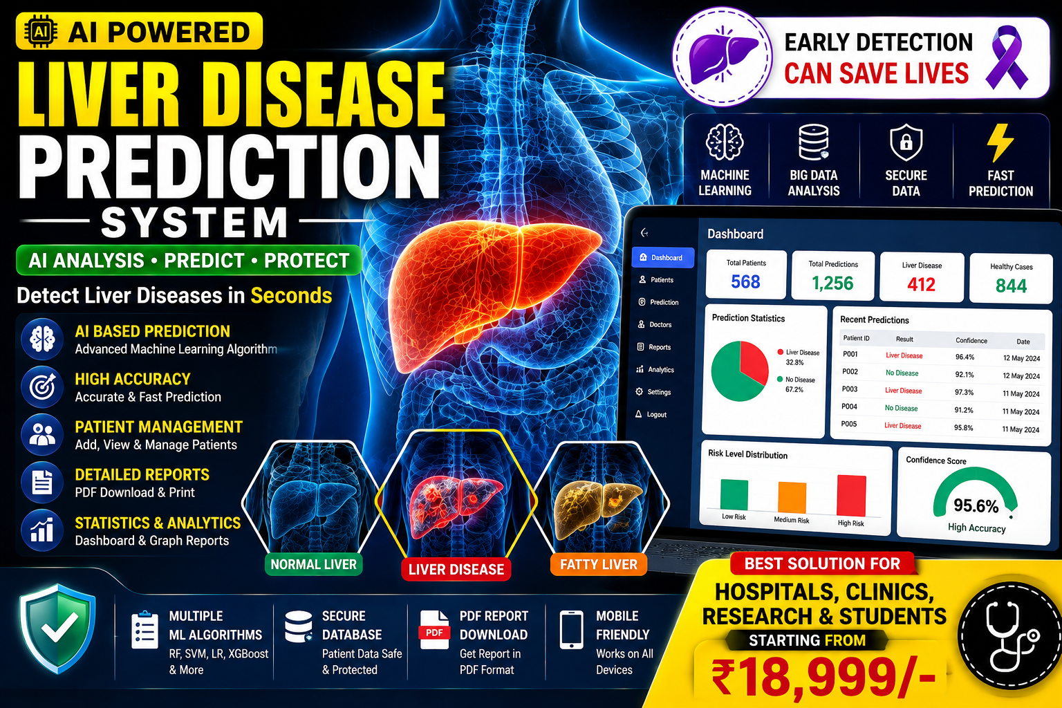 AI Liver Disease Prediction System Using Machine Learning