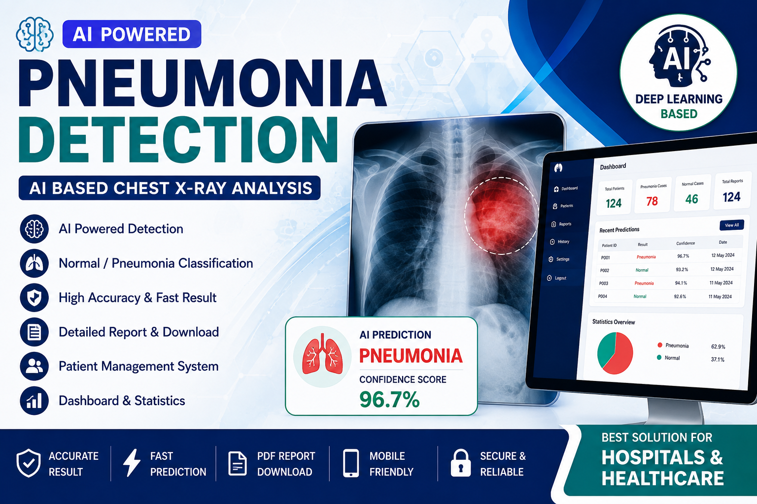 AI Pneumonia Detection System (Chest X-Ray Analysis)